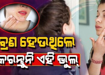 ବ୍ରଣ ସମସ୍ୟାରୁ ମୁକ୍ତି ଦେଇପାରିବ ଆଳୁ