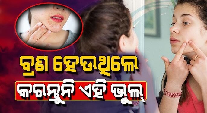 ବ୍ରଣ ସମସ୍ୟାରୁ ମୁକ୍ତି ଦେଇପାରିବ ଆଳୁ