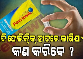 ଯଦି ଆପଣଙ୍କ ହାତରେ ଫେଭିକ୍ୱିକ ଲାଗେ, ତାହେଲେ କଣ କରିବେ?