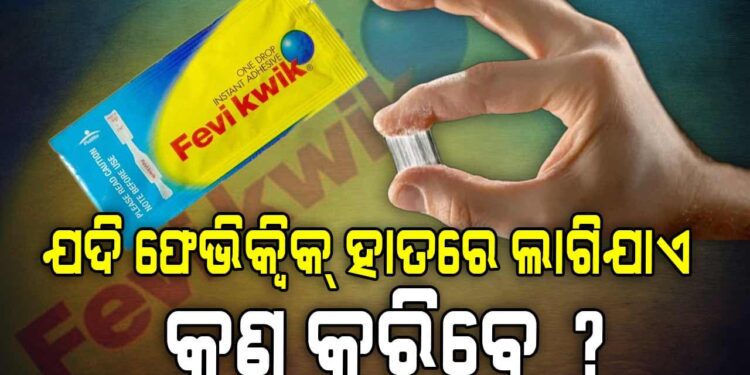 ଯଦି ଆପଣଙ୍କ ହାତରେ ଫେଭିକ୍ୱିକ ଲାଗେ, ତାହେଲେ କଣ କରିବେ?