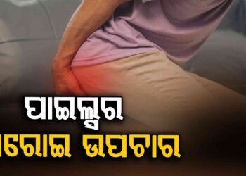 ପାଇଲ୍ସର ଘରୋଇ ଉପଚାର, ମାତ୍ର ୩ ଦିନରେ ମିଳିବ ଆରାମ…!