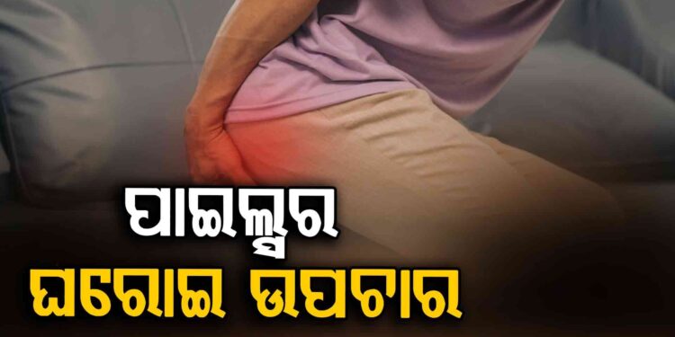 ପାଇଲ୍ସର ଘରୋଇ ଉପଚାର, ମାତ୍ର ୩ ଦିନରେ ମିଳିବ ଆରାମ…!