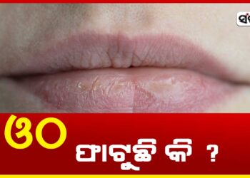 ଶୀତ ଦିନରେ ଆପଣଙ୍କ ଓଠ ଫାଟୁଛି କି ? ଜାଣନ୍ତୁ କଣ କରିବେ..