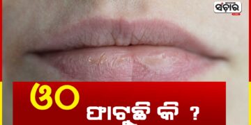 ଶୀତ ଦିନରେ ଆପଣଙ୍କ ଓଠ ଫାଟୁଛି କି ? ଜାଣନ୍ତୁ କଣ କରିବେ..