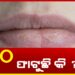 ଶୀତ ଦିନରେ ଆପଣଙ୍କ ଓଠ ଫାଟୁଛି କି ? ଜାଣନ୍ତୁ କଣ କରିବେ..