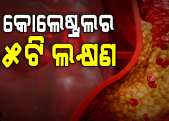 କୋଲେଷ୍ଟ୍ରଲର ଲକ୍ଷଣ କଣ?