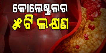 କୋଲେଷ୍ଟ୍ରଲର ଲକ୍ଷଣ କଣ?