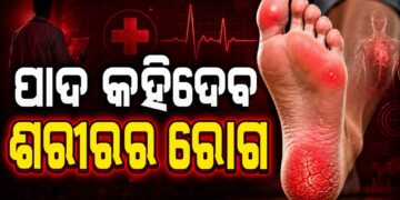 ଆପଣଙ୍କ ପାଦର ଏହି ଲକ୍ଷଣରୁ ଜାଣନ୍ତୁ ରୋଗର ସଂକେତ