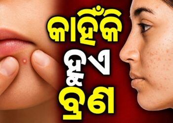 ଭୁଲରେ ଵି ଲଗାନ୍ତୁନି ଏହିସବୁ ଜିନିଷ, ନହେଲେ ଭର୍ତ୍ତି ହୋଇଯିବ ବ୍ରଣ