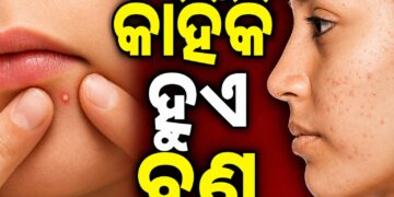 ଭୁଲରେ ଵି ଲଗାନ୍ତୁନି ଏହିସବୁ ଜିନିଷ, ନହେଲେ ଭର୍ତ୍ତି ହୋଇଯିବ ବ୍ରଣ