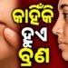 ଭୁଲରେ ଵି ଲଗାନ୍ତୁନି ଏହିସବୁ ଜିନିଷ, ନହେଲେ ଭର୍ତ୍ତି ହୋଇଯିବ ବ୍ରଣ