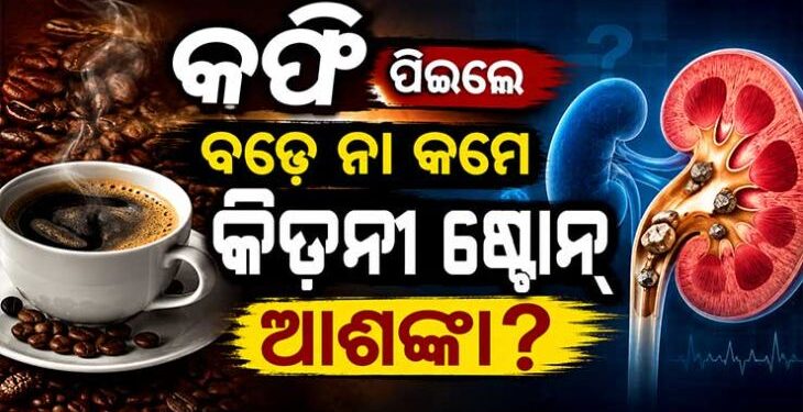 କିଡନୀ ଷ୍ଟୋନ୍ ଏବଂ କଫି ମଧ୍ୟରେ ସମ୍ପର୍କ, ଜାଣନ୍ତୁ ଅଜଣା କଥା